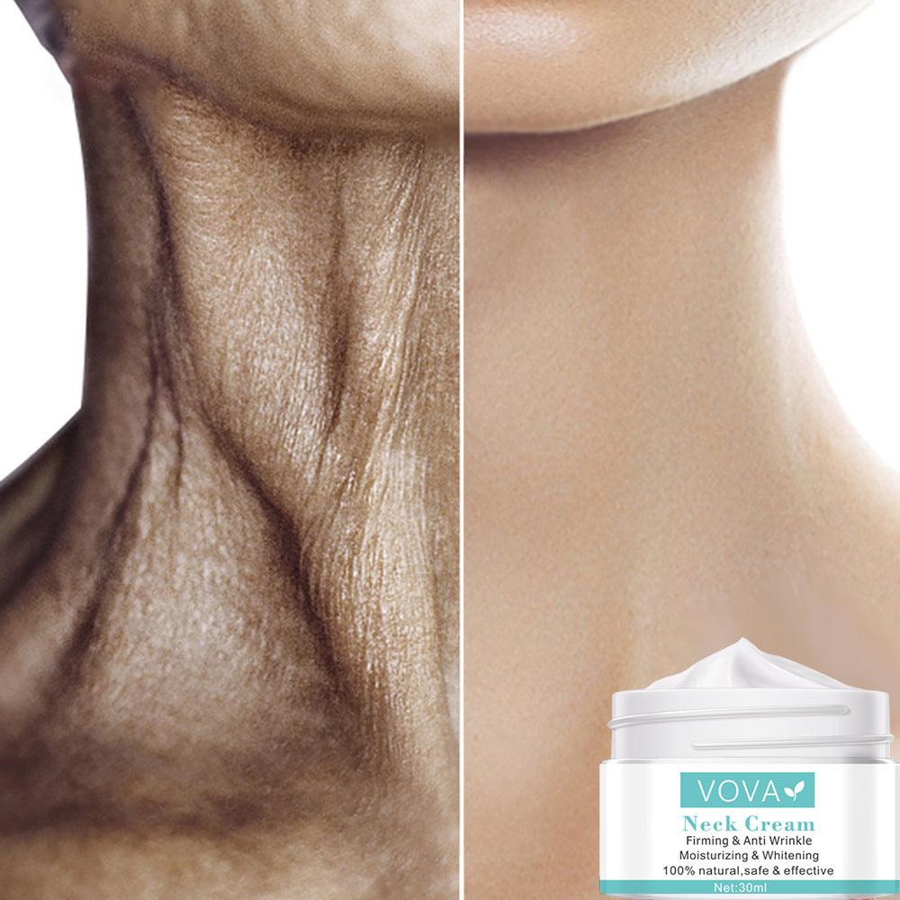 Before and after comparison of neck skin showing effects of VOVA firming and anti-wrinkle neck cream 30ml moisturizing and whitening